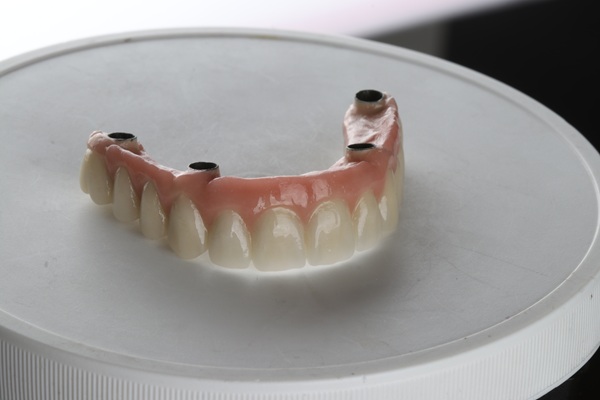 How To Care For Your All On   Implants