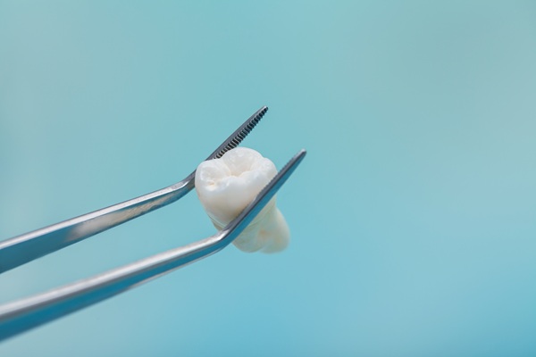 Wisdom Teeth Extractions: When, Why, And What To Expect